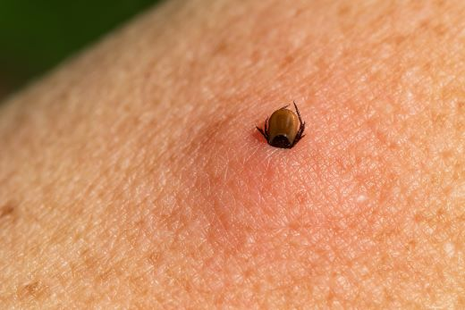 Ticks in the Garden: How to Protect Yourself Properly